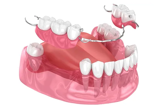 DENTURES