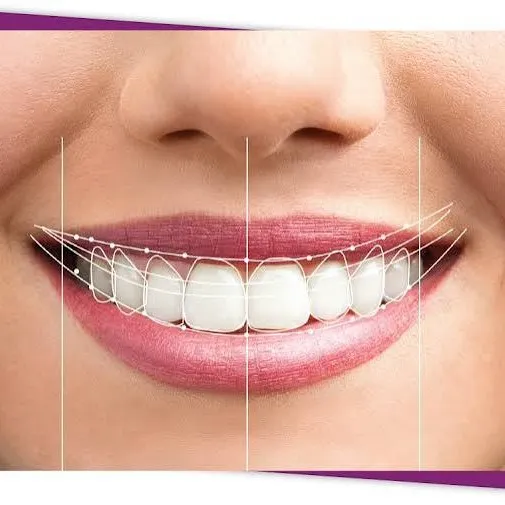 Smile Design